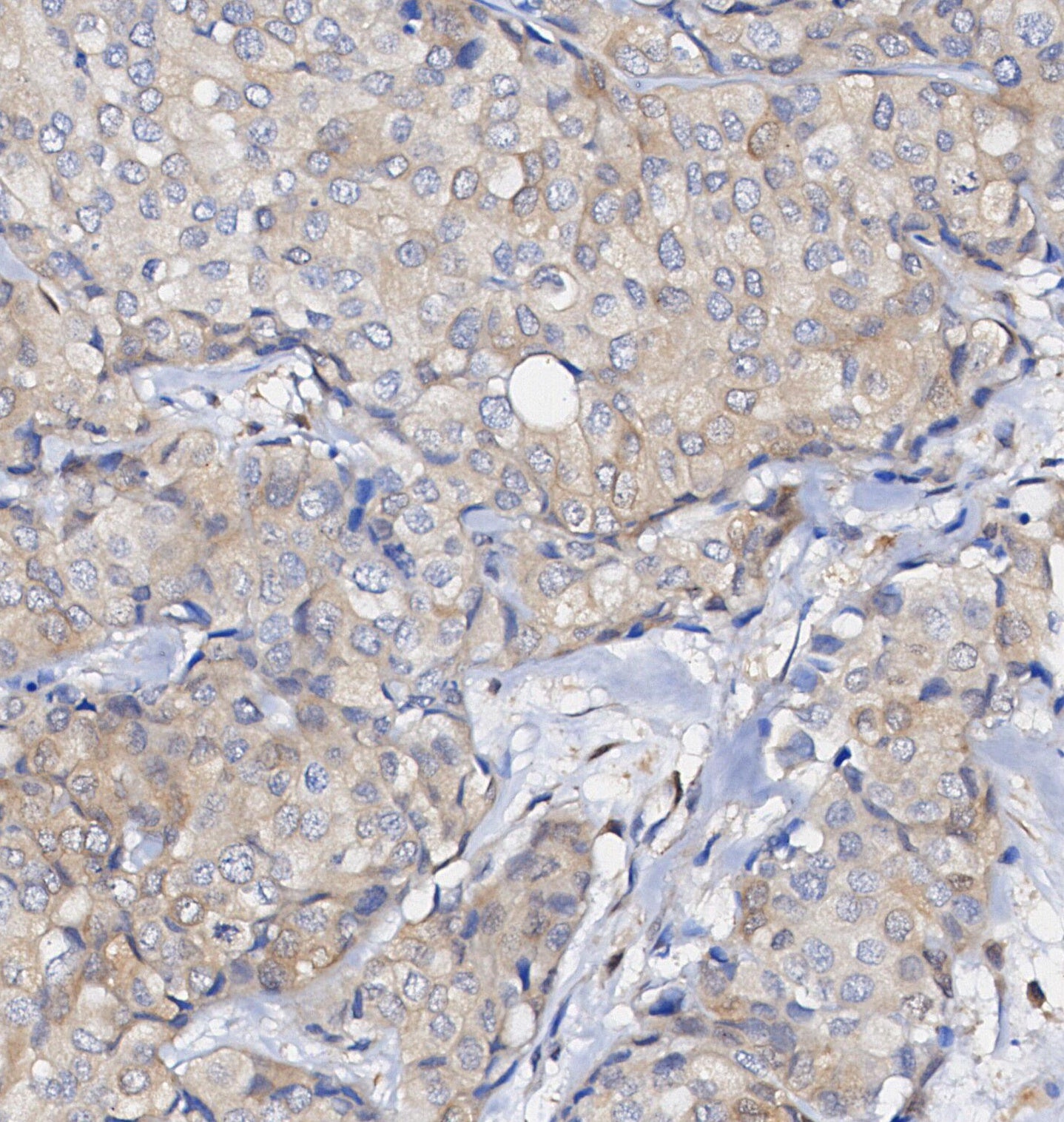 PLC1 Antibody