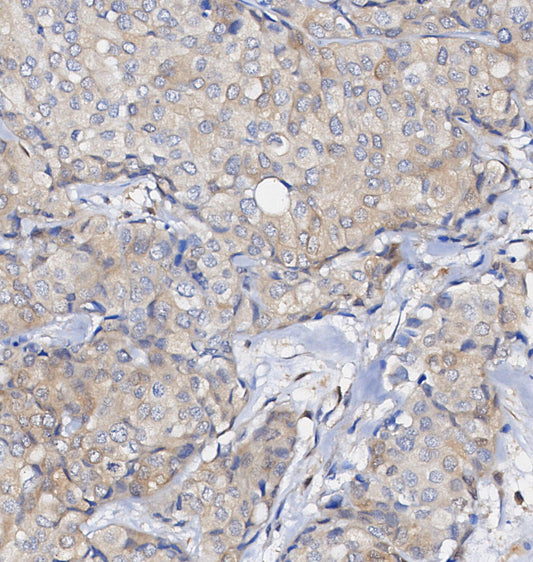 PLC1 Antibody