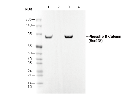 Phospho-β-Catenin (Ser552) Antibody