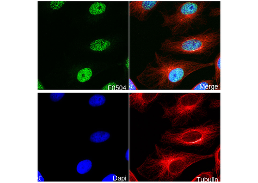 RING1B Antibody