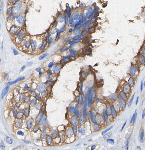 TOMM20 Antibody