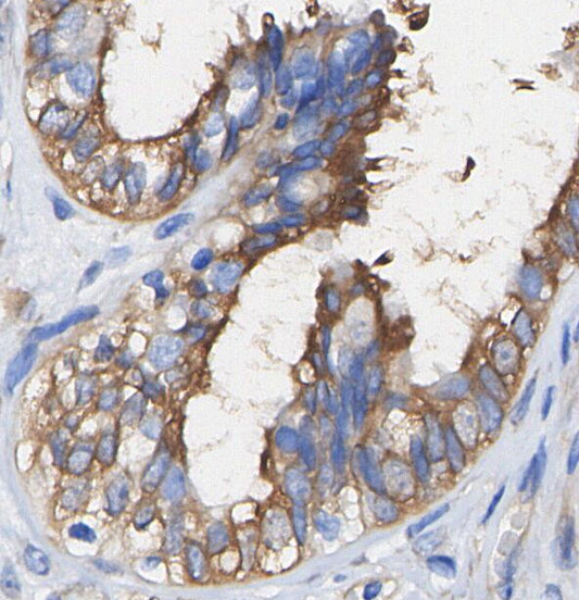 TOMM20 Antibody