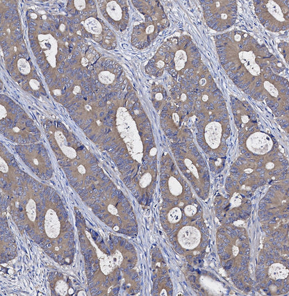 Argonaute-2 Antibody