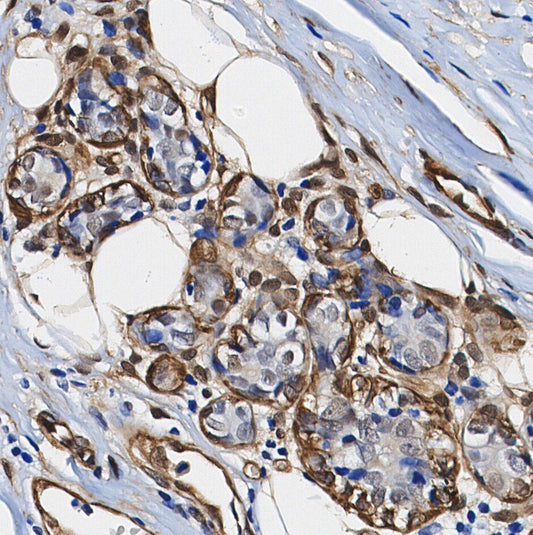 IRF3 Antibody