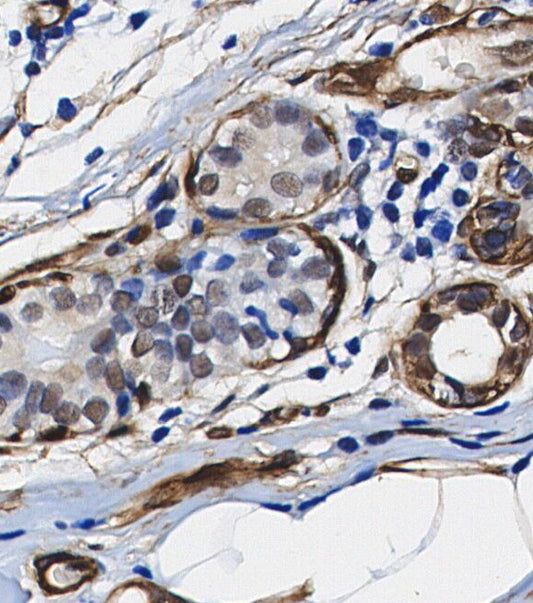 Ubiquitin (linkage-specific Lys48) Antibody