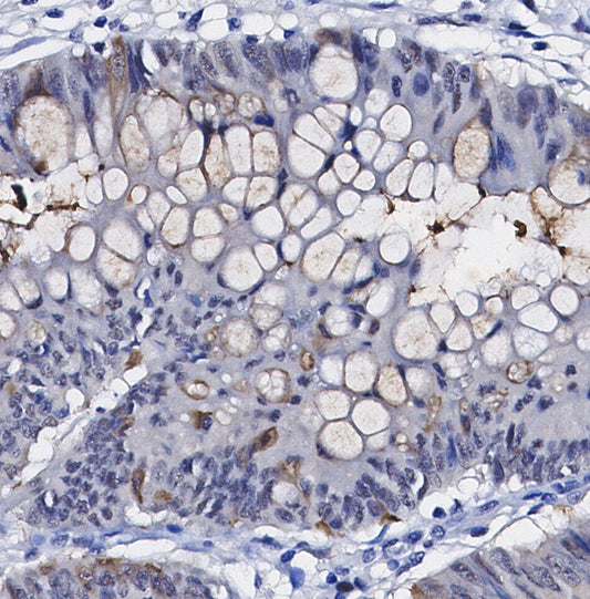 Ubiquitin (linkage-specific Lys63) Antibody