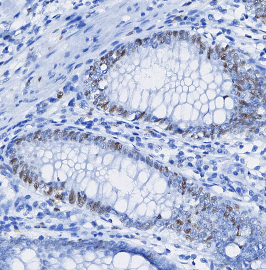 CDK7 Antibody