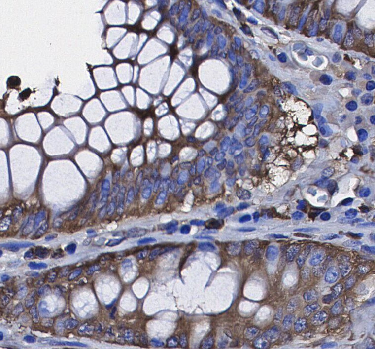 TrkC Antibody