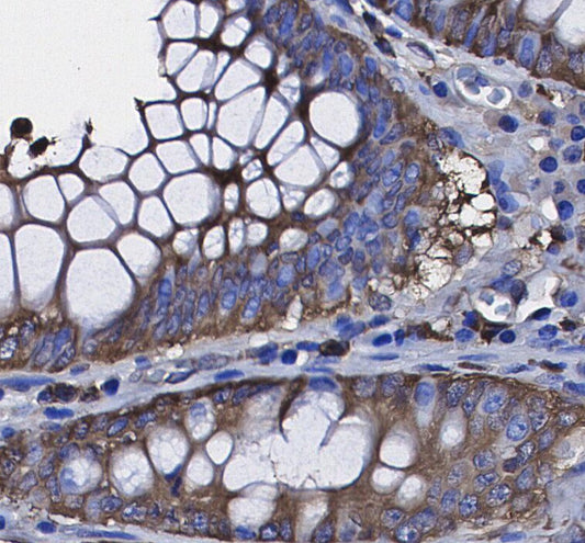 TrkC Antibody