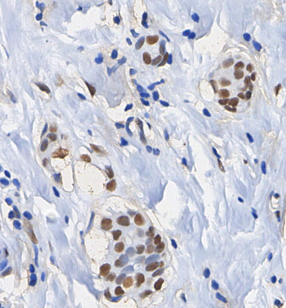 AML1 Antibody