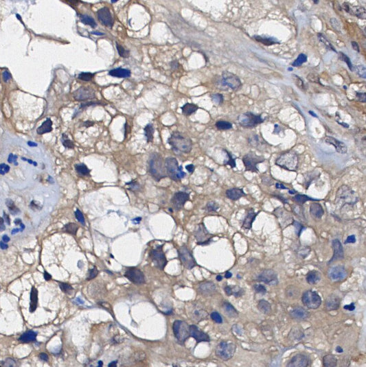 Glycogen Synthase (GYS1/GYS2) Antibody