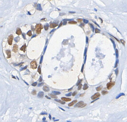IRF-8 Antibody