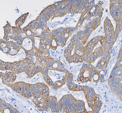 Keratin 8/18 Antibody