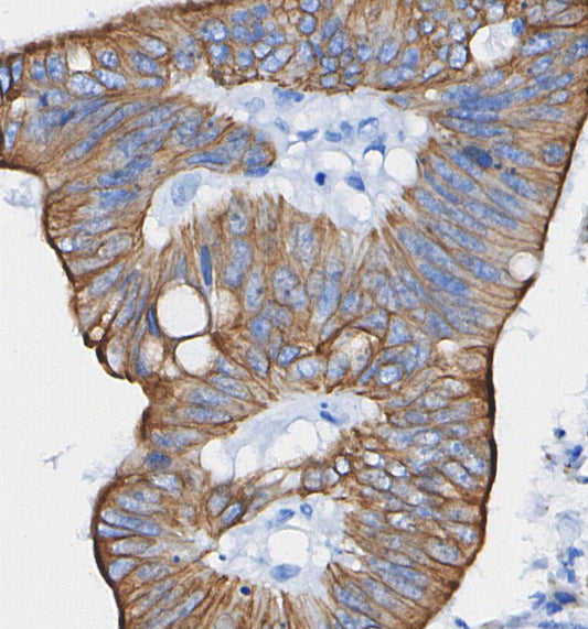 Lyn Antibody