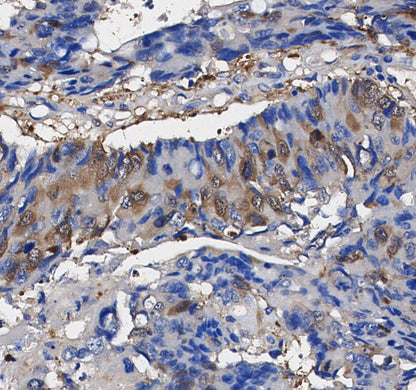 NFAT1 Antibody