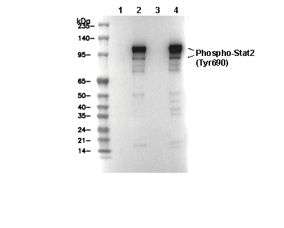 Phospho-STAT2 (Tyr690) Antibody