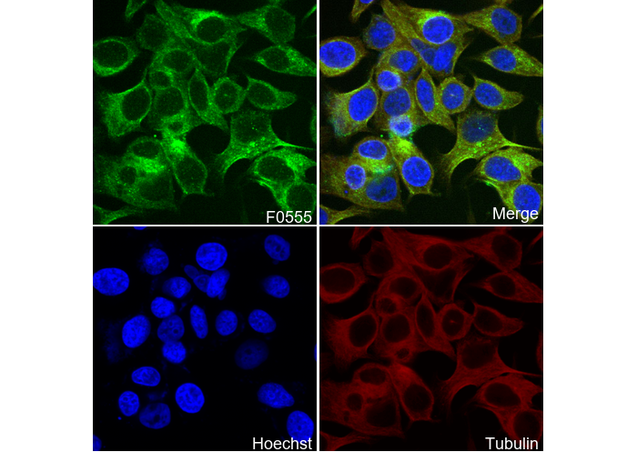 Phospho-STAT6 (Tyr641) Antibody