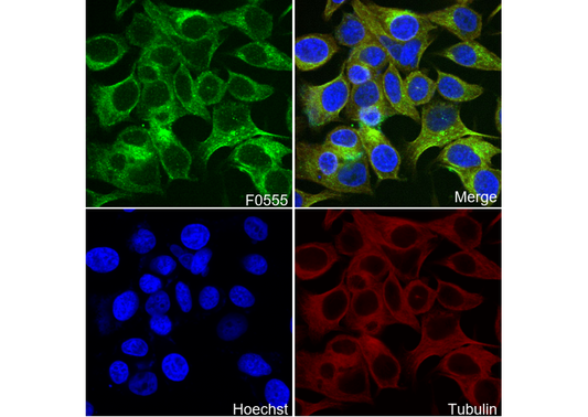 Phospho-STAT6 (Tyr641) Antibody