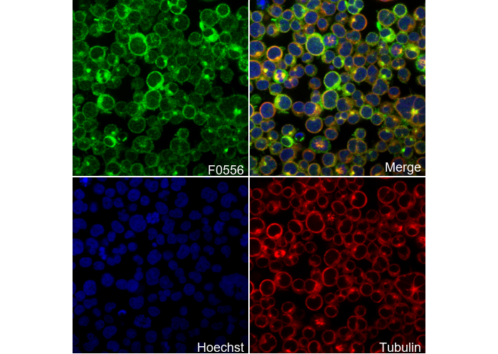 Phospho-Zap-70 (Tyr319)/Syk (Tyr352) Antibody