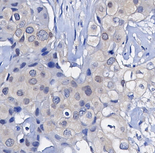 Phospho-p90 RSK (Thr359) Antibody