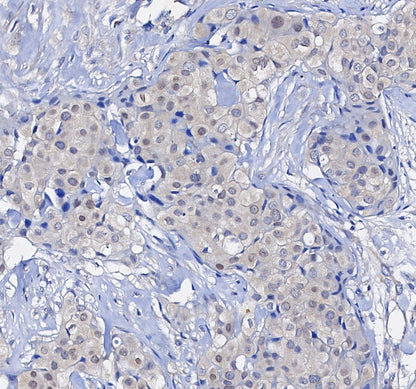 Bmi1 Antibody
