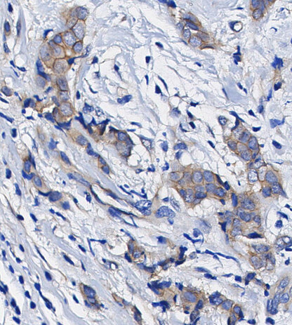 EPAC1 Antibody