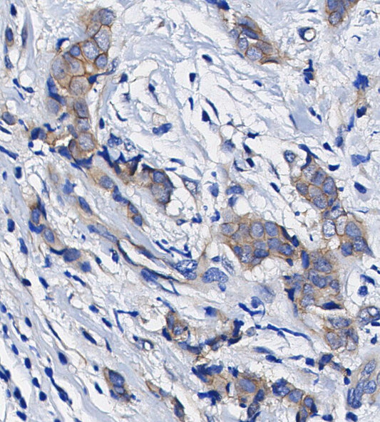 EPAC1 Antibody