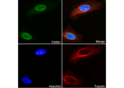 MCM2 Antibody