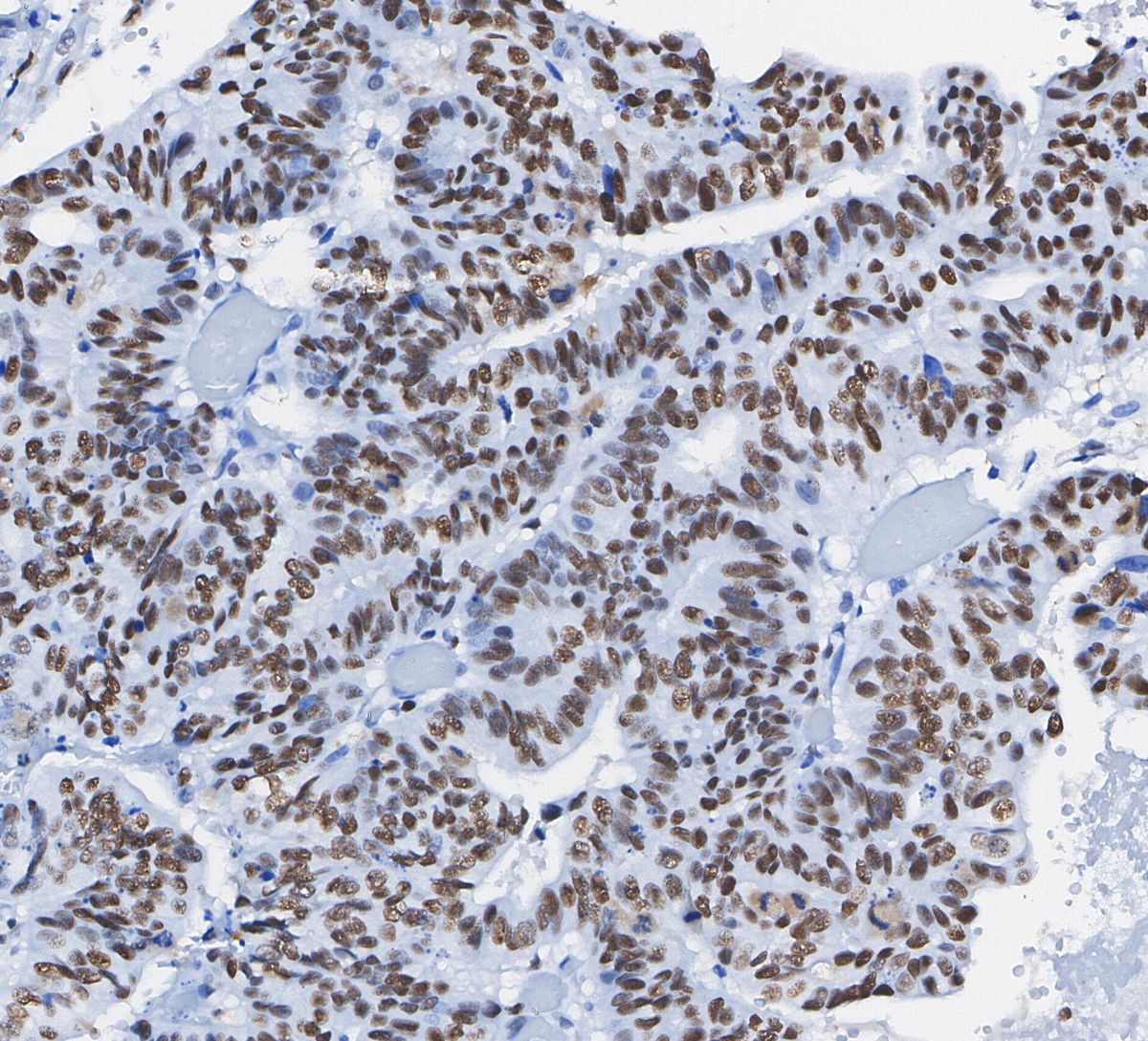 MCM2 Antibody