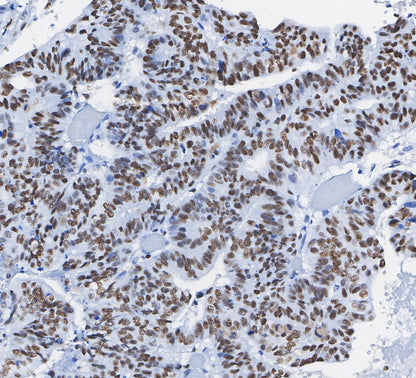 MCM2 Antibody