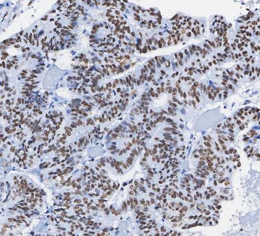 MCM2 Antibody
