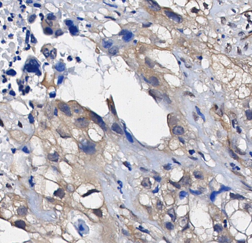 NF-κB2 p100/p52 Antibody