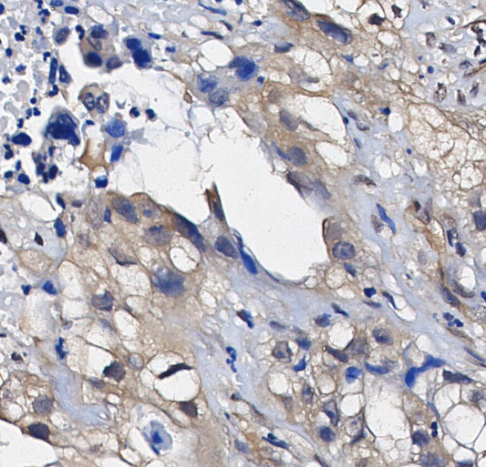 NF-κB2 p100/p52 Antibody