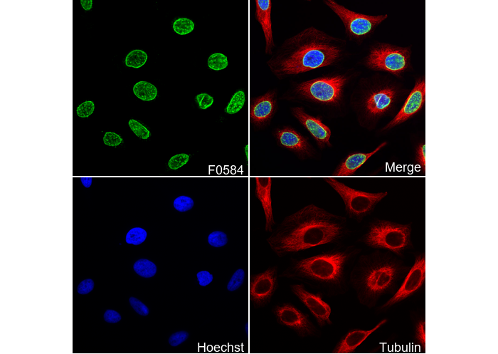 NUP98 Antibody