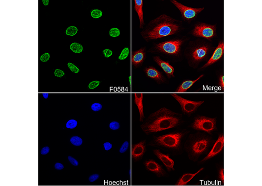 NUP98 Antibody