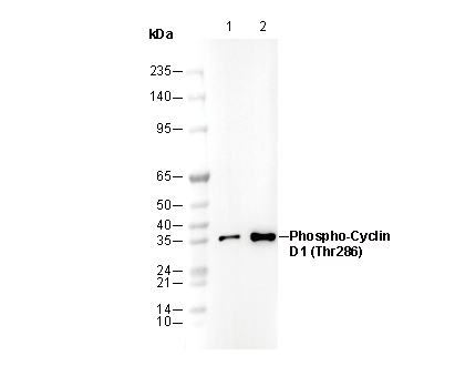 Phospho-Cyclin D1 (Thr286) Antibody