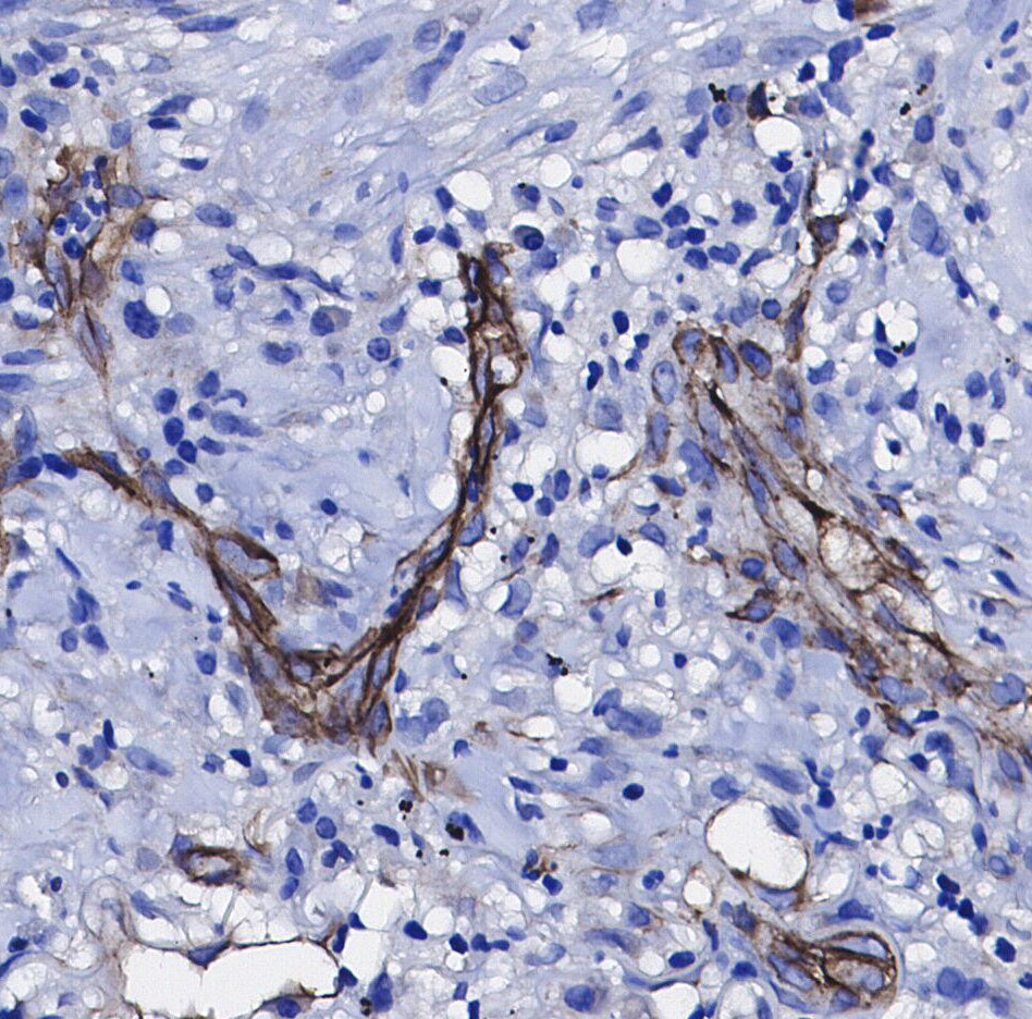 TRAIL Antibody