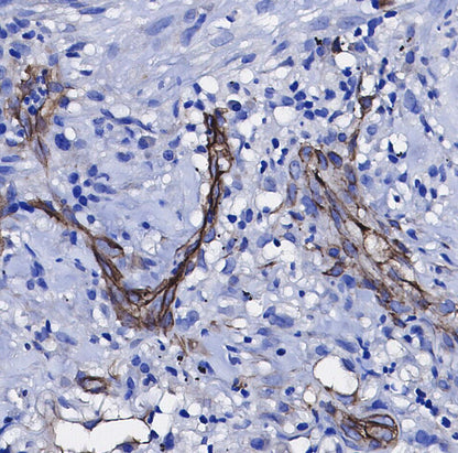 TRAIL Antibody