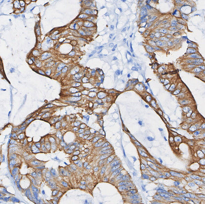 ASCT2 Antibody