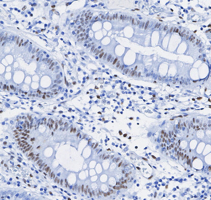HAUSP Antibody