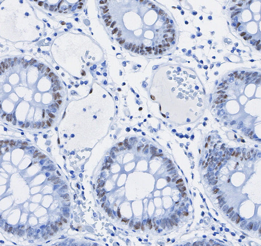 HIF-1β/ARNT Antibody