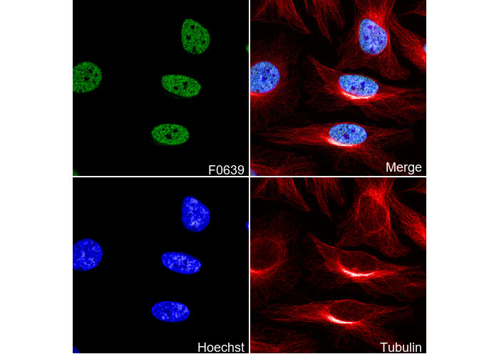 Histone H3 (mono methyl Lys4) Antibody