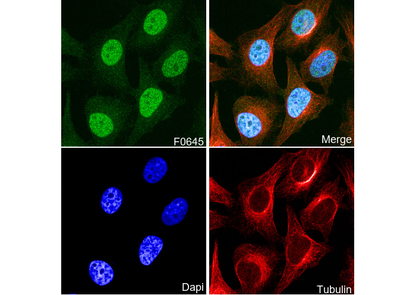 PP2A A Subunit Antibody