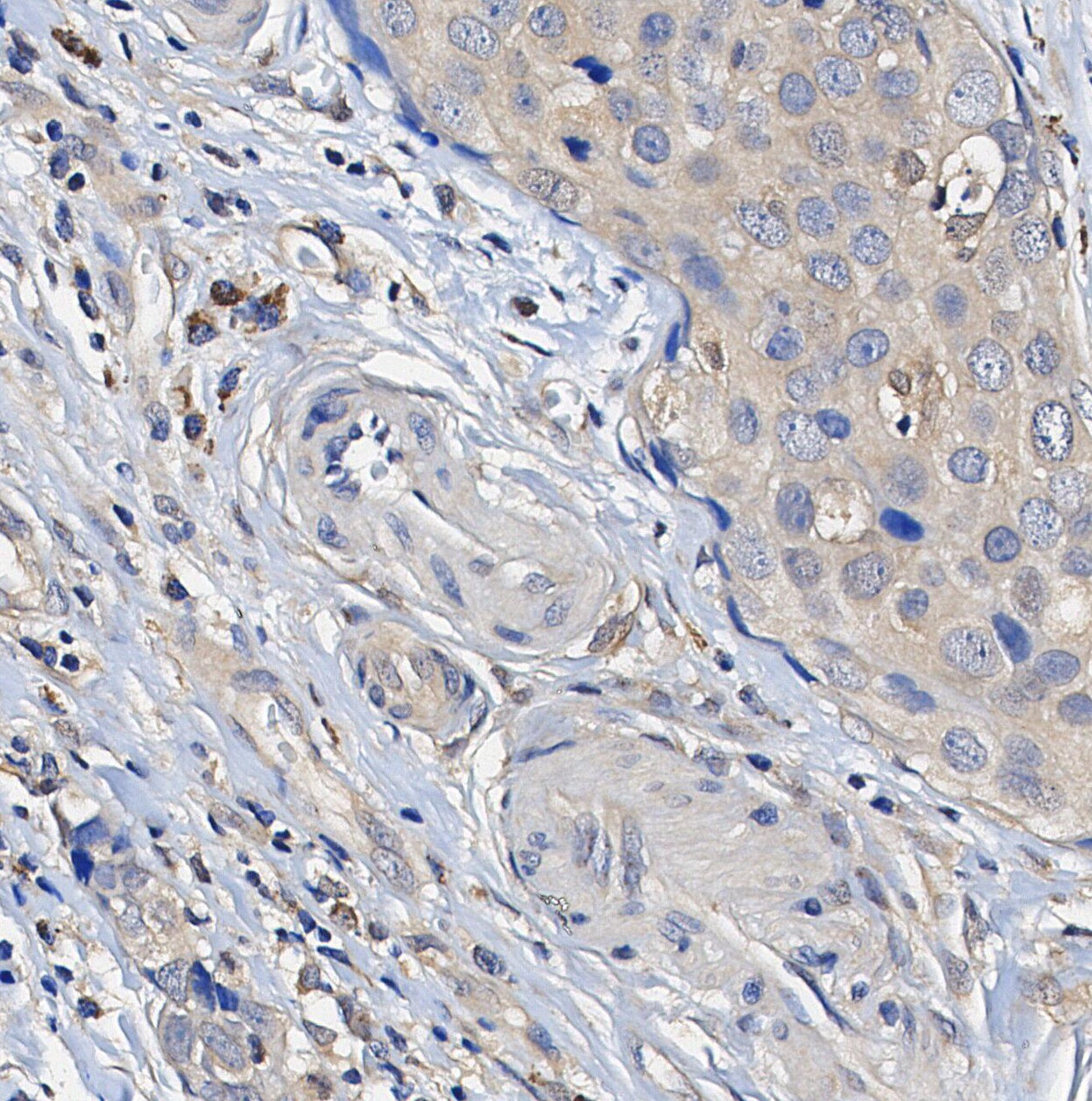 PP2A A Subunit Antibody