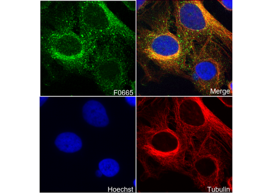 WAVE-2 Antibody