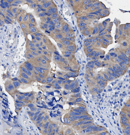 β-Arrestin 2 Antibody