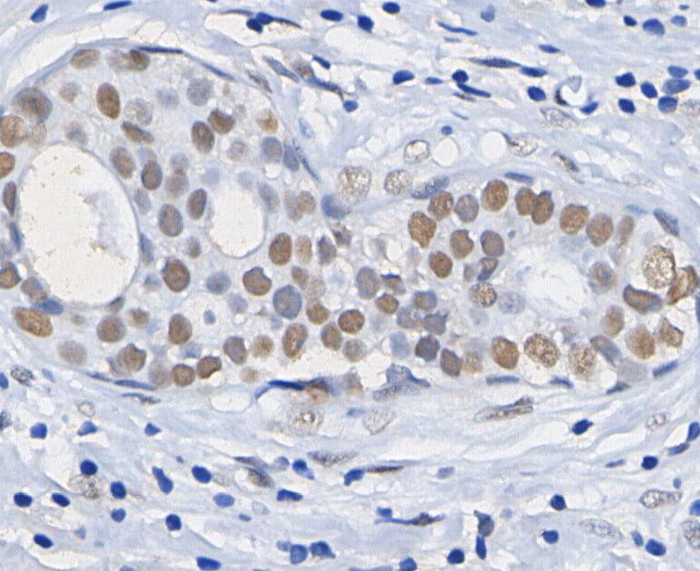 Acetyl-Histone H3 (Lys18) Antibody