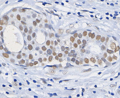 Acetyl-Histone H3 (Lys18) Antibody