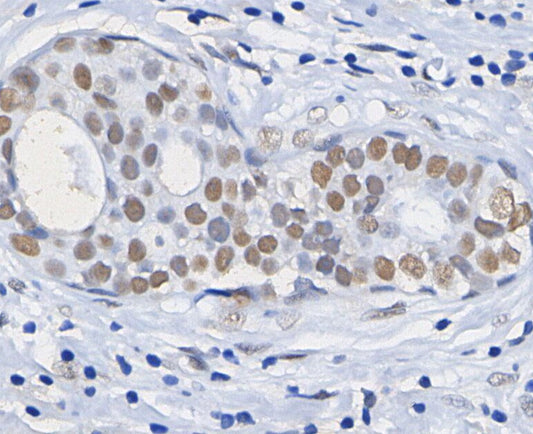 Acetyl-Histone H3 (Lys18) Antibody