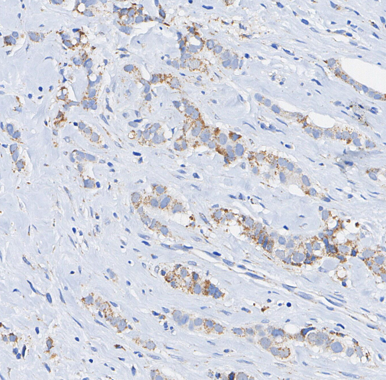 LAMTOR1/C11orf59 Antibody